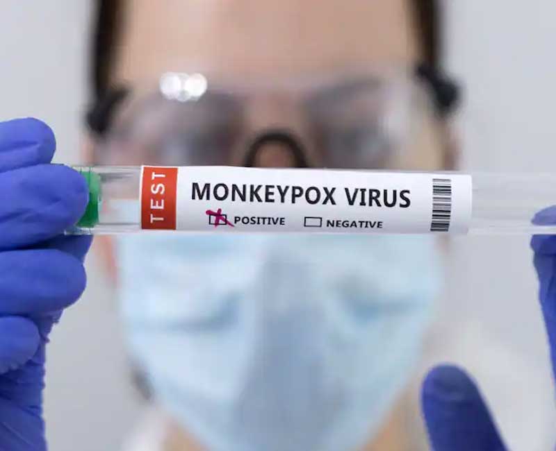 Another case of monkeypox in Delhi